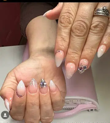 The beauty spot