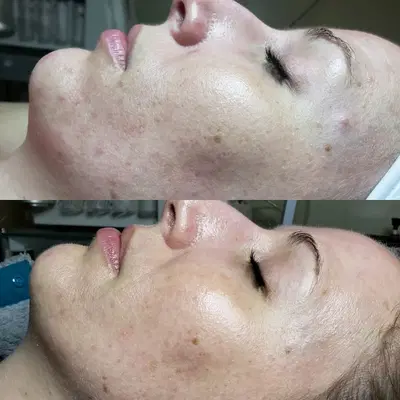 Beautiful Skin by Molly