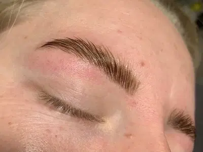 Frckld Skin Co.