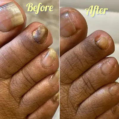 Foot Beauty Care