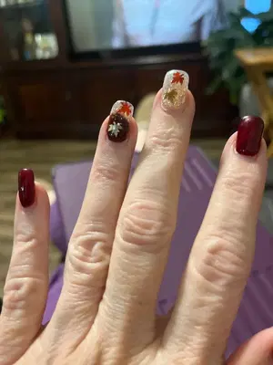 Dalton Nail